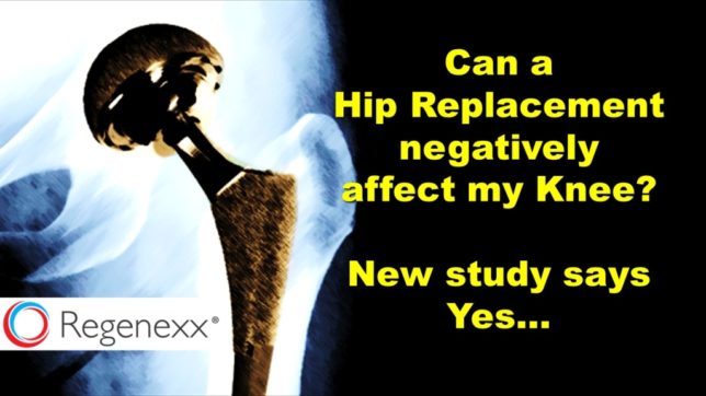 hip replacement risks include disrupting hip and knee alignment