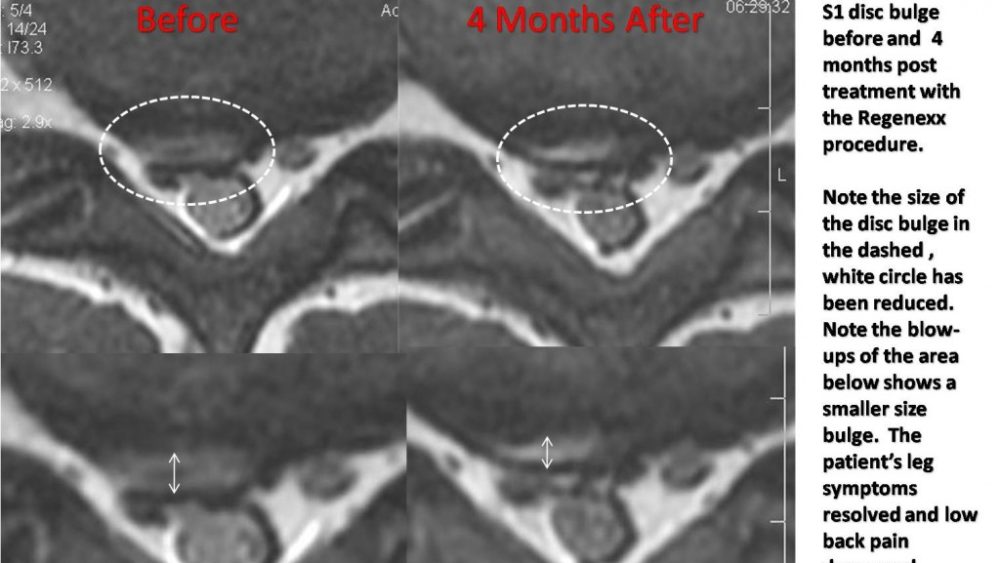 Employee Benefits or We Wouldn’t do Anything on You We Don’t Do on Ourselves