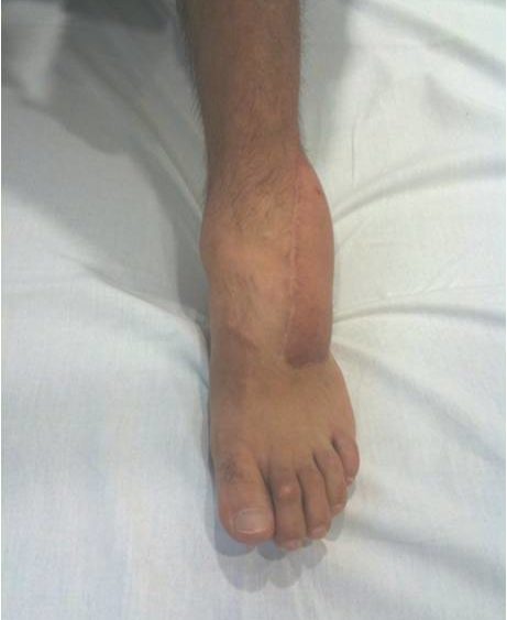 Big Surgeries, Big Complications