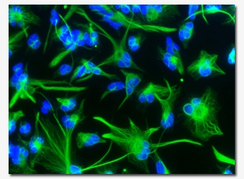 No free stem cell lunch…