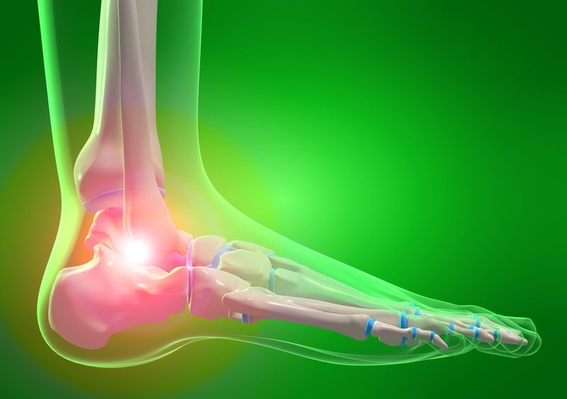Ankle Arthritis Pain due to Deltoid Ligament Injury