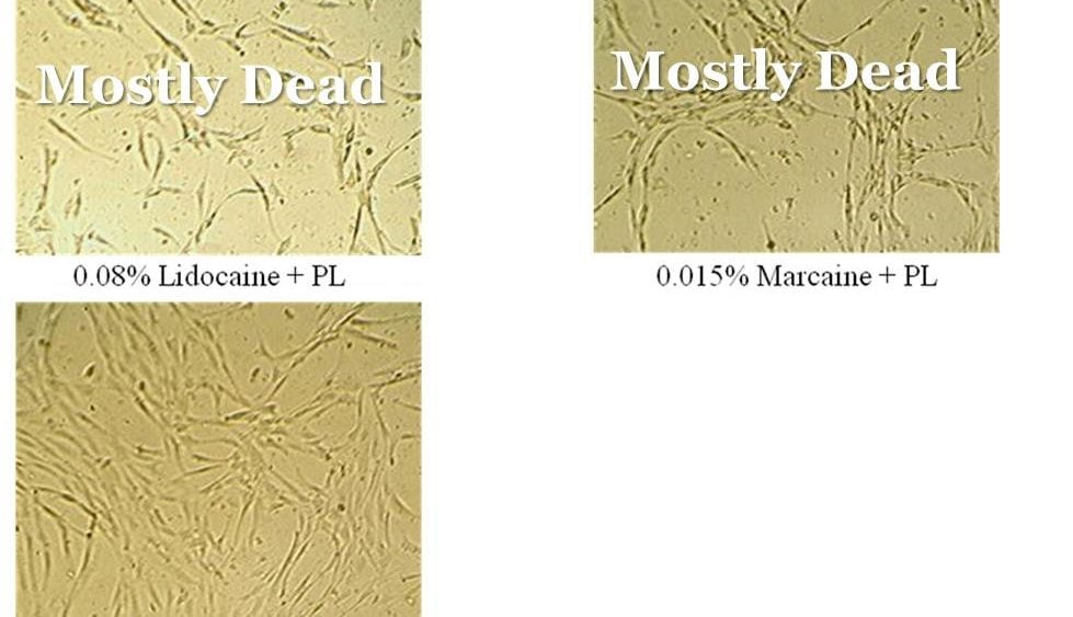 The Regenexx Difference-Cell Viability or are the stem cells you’re getting dead on arrival?