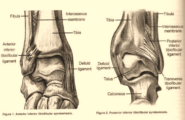 Stem Cell Treatment of Ankle Pain in an Ankle Fusion Candidate