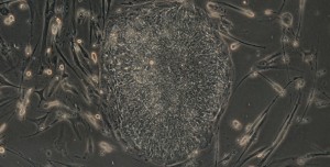 IPS Cells show “a consistent pattern of reprogramming errors”