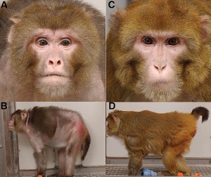 Sirt-1, Middle Age Aches, and Arthritis