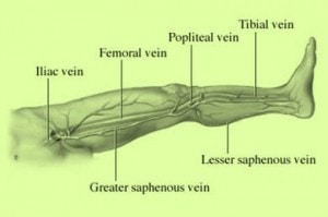 AAOS: Certain Patients at Higher Risk for Blood-clots with Knee Arthroscopy