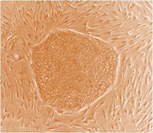 More Trouble with IPS Cells