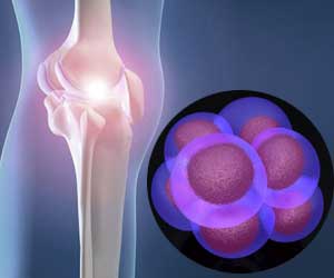 New Study Shows Same Day Stem Cells with Knee Surgery better than Knee Surgery Alone