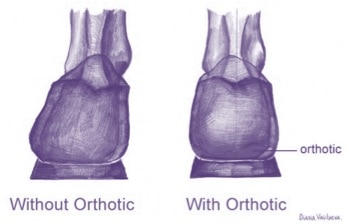 Patellofemoral or Knee Cap Pain and Orthotics: Is there a Connection between the Foot and Knee?