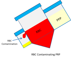 prp colorado platelets machine