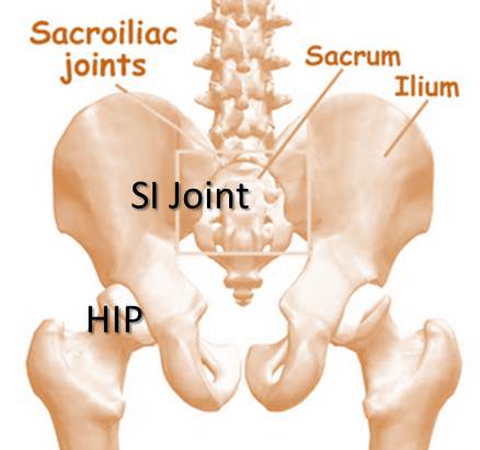 You be the Judge: Hip Replacement for Back of Hip Pain?