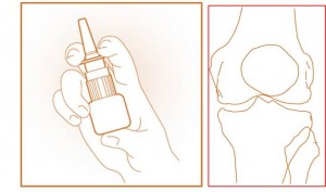 A Nosespray may help your Knee Arthritis Symptoms!