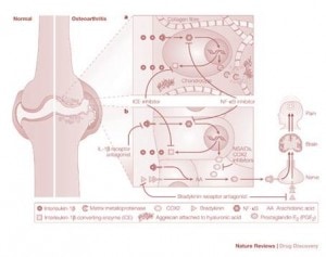 “DMOAD’omania”-Can Certain Drugs delay the need for Knee Replacement?