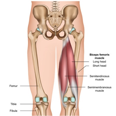 Medical illustration showing the anatomy of the hamstring