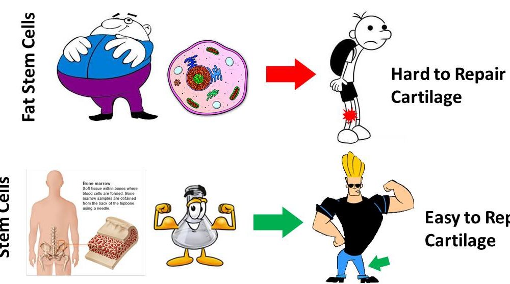 Fat Stem Cells Knee Injections: Getting Fat Stem Cells to Repair Cartilage is Still a Problem