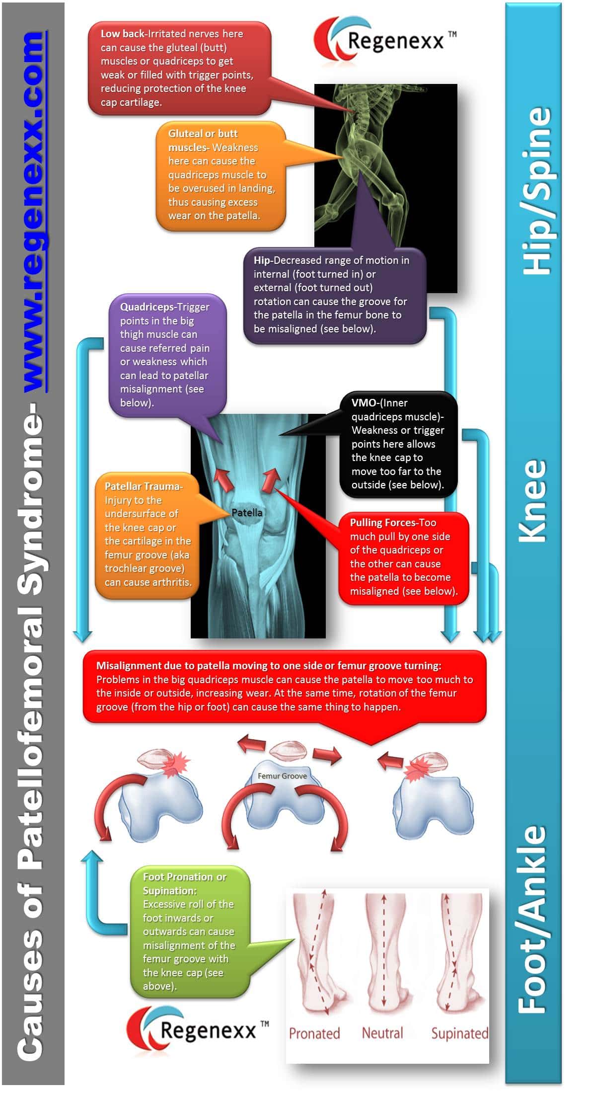 patellofemoral pain syndrome infographic