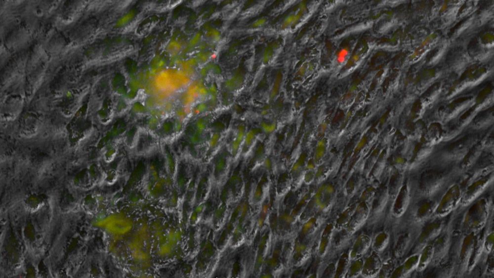 Regenexx Lab Research: Getting your Stem Cells to produce More Cartilage