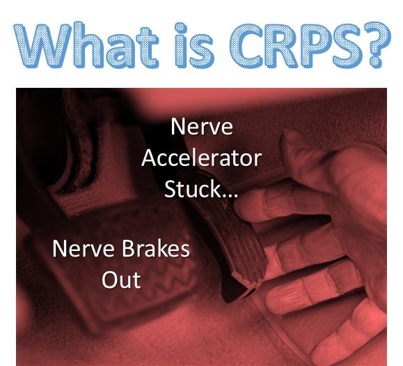 What is CRPS? Does Regenerative Medicine Have a Role?