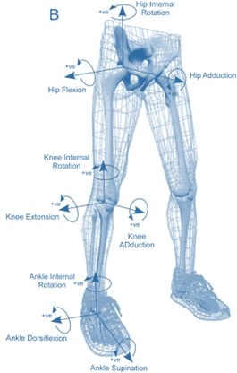 Changes in How You Move Due to Knee Arthritis Can Fry Other Joints and Impact Your Recovery