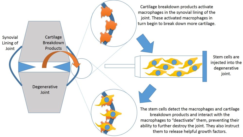Stem Cells Help Prevent Arthritis or How to Turn the Bad Pac Man Cells into Good Guys