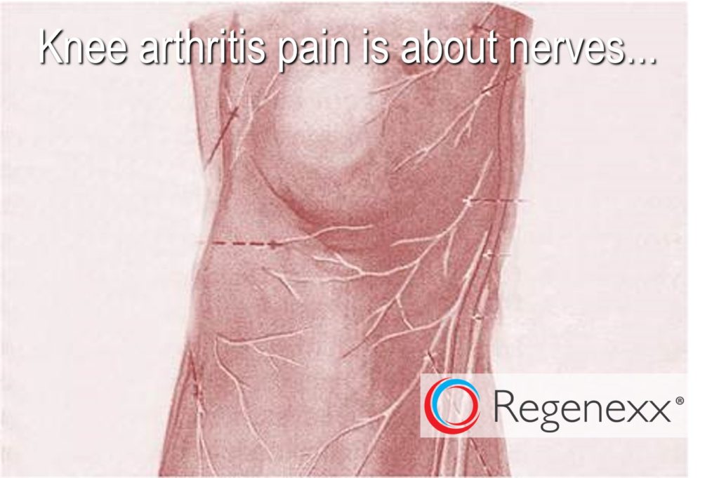 Nerves In the Knee Joint More Evidence that the Pain of Arthritis is Caused by Nerves
