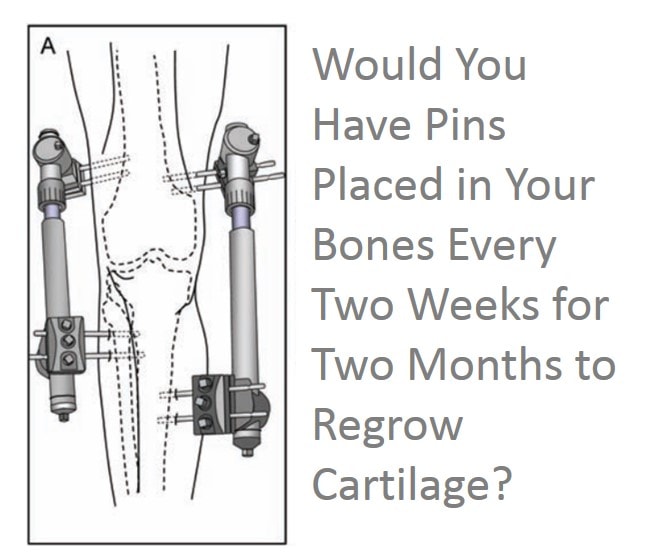 Can an Aggressive Knee Surgical Implant Regrow Cartilage?
