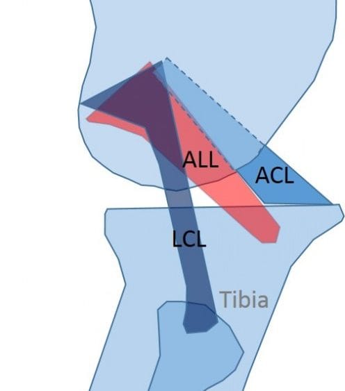 Houston We Have a New Ligament: Does the Newly Discovered ALL Ligament Explain Why Some ACL Injuries Can’t Be Fixed?