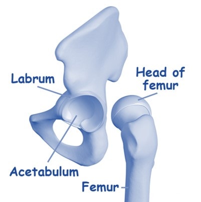 Hip Labrum Pain Surgery? 4 New Studies Question Why.