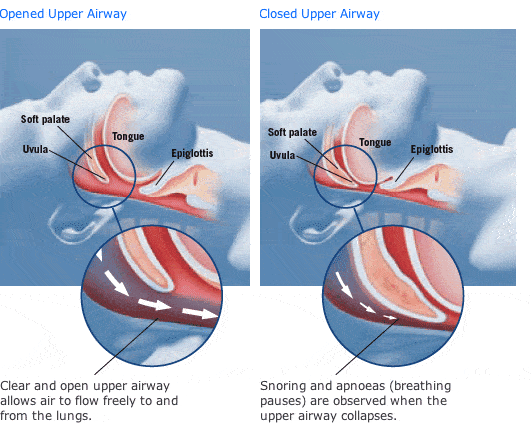 sleep apnea stronger bone stem cells