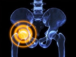 symptoms of cobalt poisoning from hip replacement