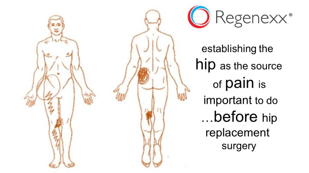 hip replacement pain