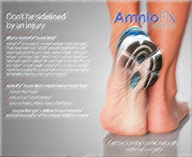 Amnio Stem Cells: Are there Stem Cells in Amniotic Tissue being Used by Sports Med Doctors?