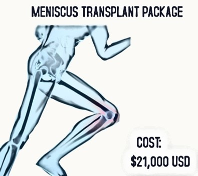 Does Meniscus Replacement Work?