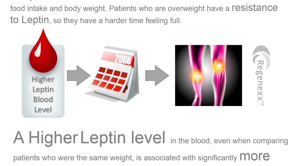 Overweight Knee Pain? A New Study Suggests its All About the Leptin