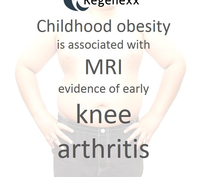 Kids Knee Problems: Many Heavier Kids have Evidence of Knee Arthritis
