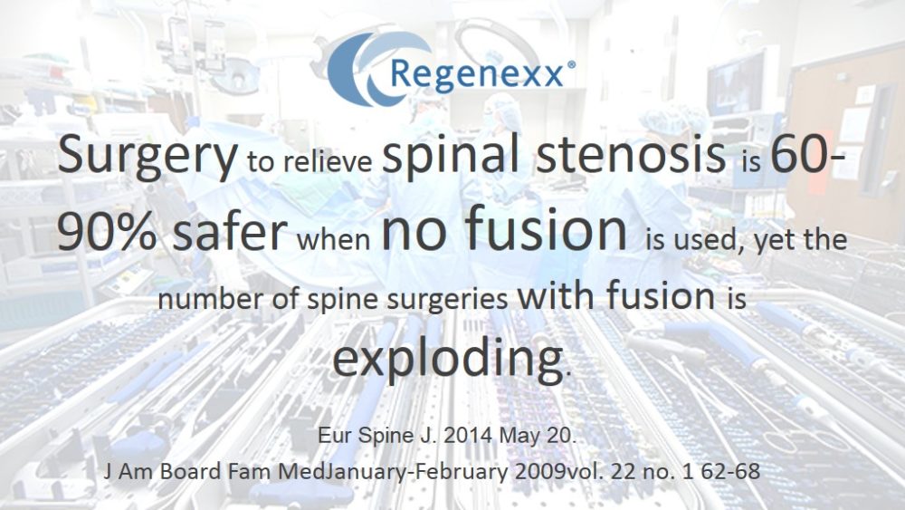 Looking for Safer Stenosis Back Surgery Recovery? Skip the Fusion!