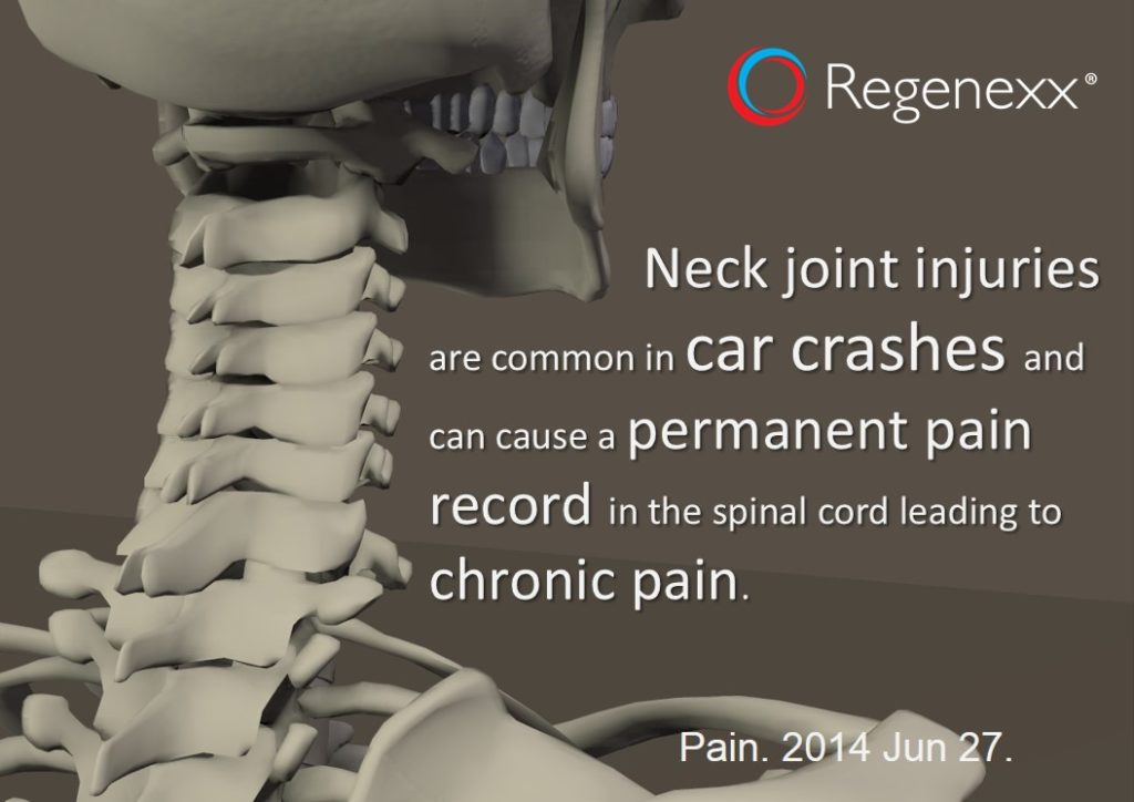 neck facet joint pain treatment
