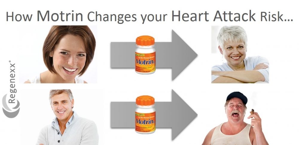 Motrin for Knee Swelling? A Visual Guide to Heart Attack Risk