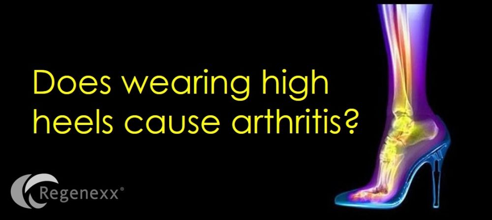 Do High Heels cause Arthritis? New Study Says No…