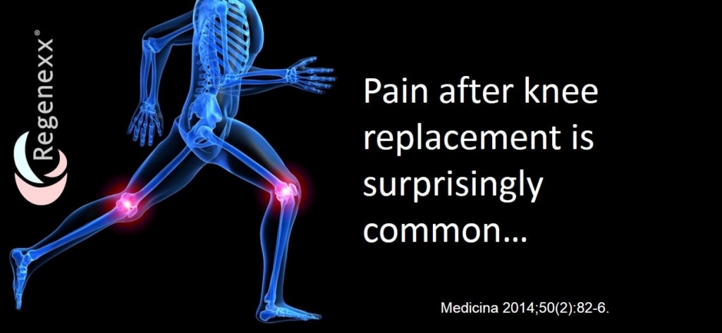 ongoing knee replacement pain
