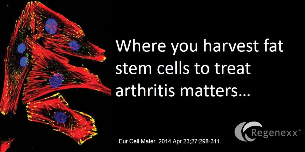 Fat Stem Cell Arthritis Treatments: Are All Fat Stem Cells Equal?