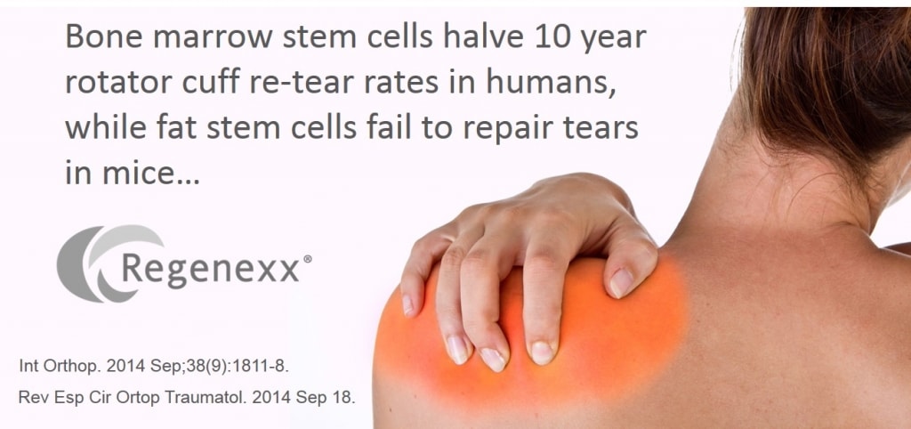 fat stem cells shoulder