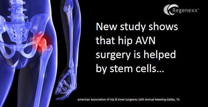 Stem Cell Treatment for Hip AVN: New Research