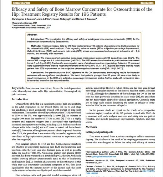 Hip Arthritis Stem Cell Research: Regenexx Publishes New Hip Paper