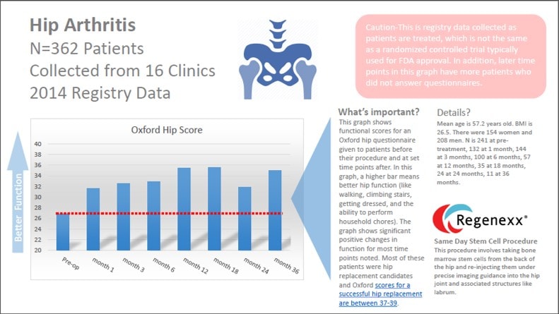 Hip Arthritis Stem Cell Treatments: New Hip Registry Data