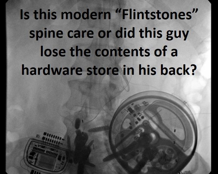 Back Surgery Concerns: Stone Age Spine Care…