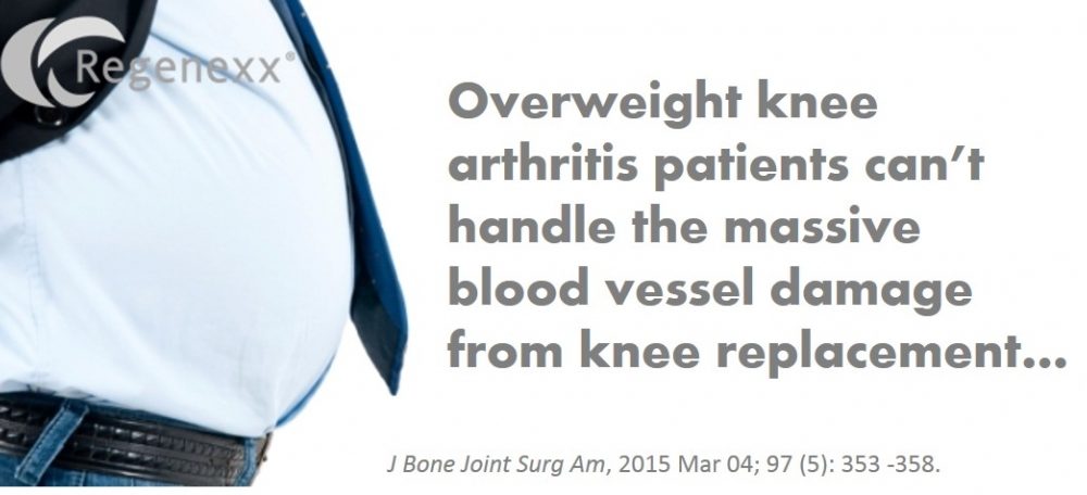 Overweight Knee Replacement Patients and Complications