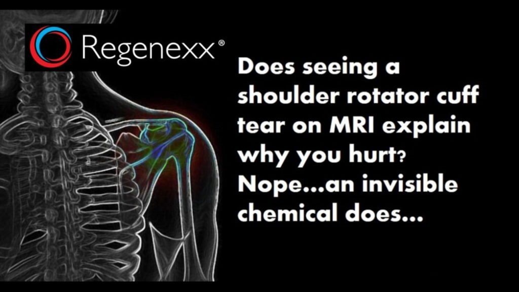 Rotator Cuff MRI