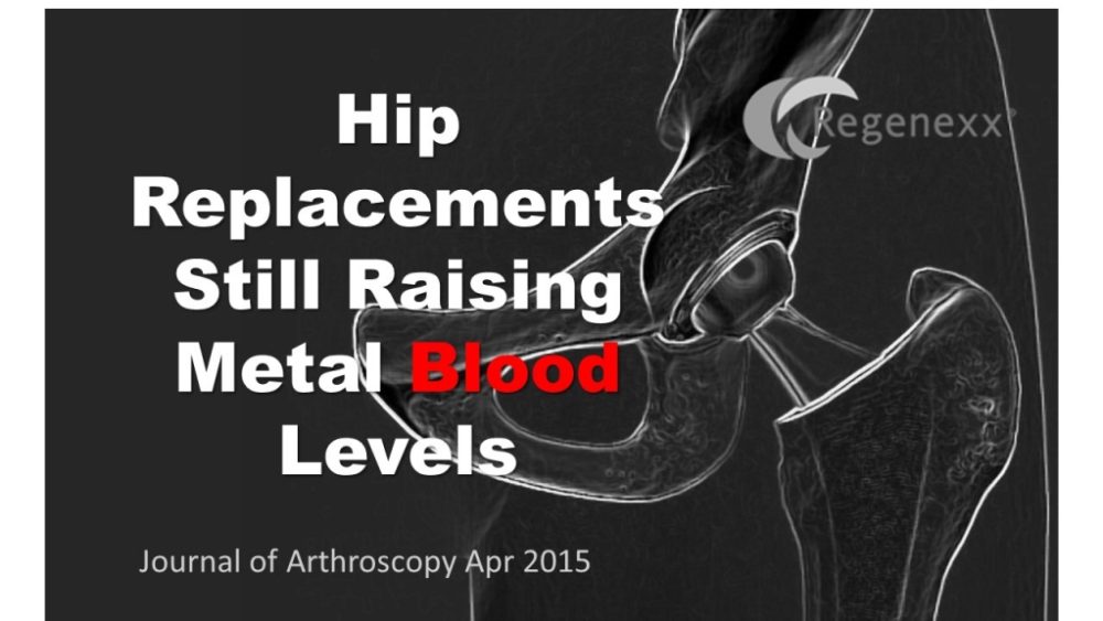 Pretty Much All Hip Implants Raise Metal Blood Levels…