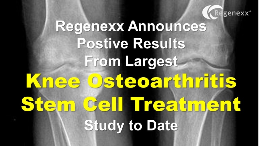 Regenexx Knee Osteoarthritis Stem Cell Treatment Study Results